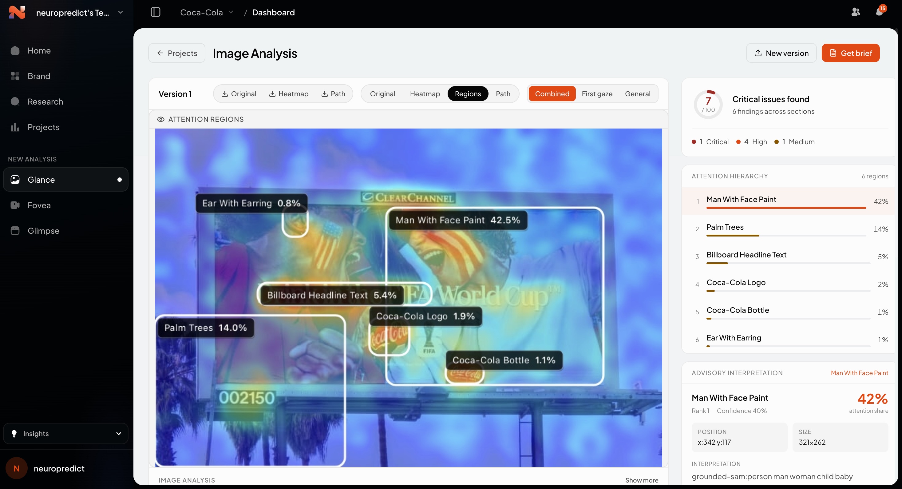 Neuropredict dashboard showing attention heatmap analysis